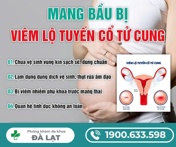 Hình ảnh minh họa